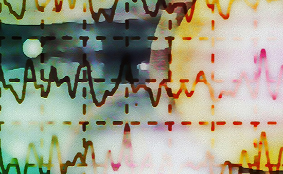 Neurodivergenz